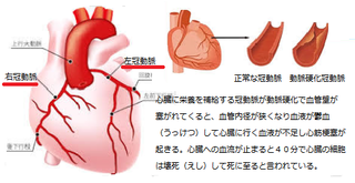 冠動脈.PNG